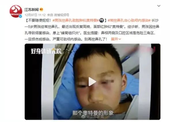 “孩子喜欢吃鼻屎怎么办？”